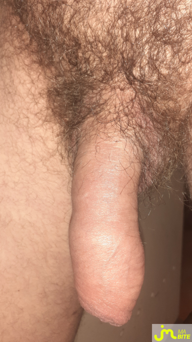 bites de Tire dessus 