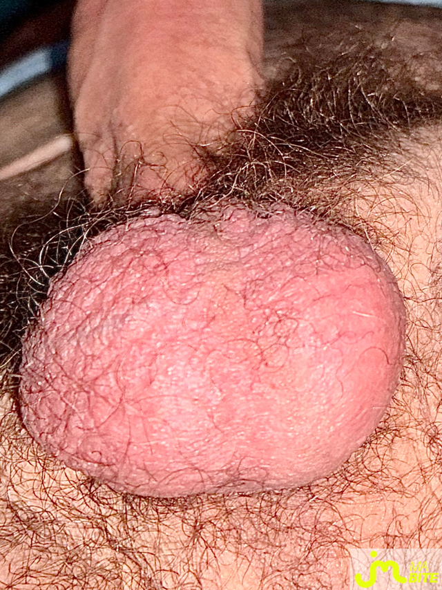 bites de Suceusedu31