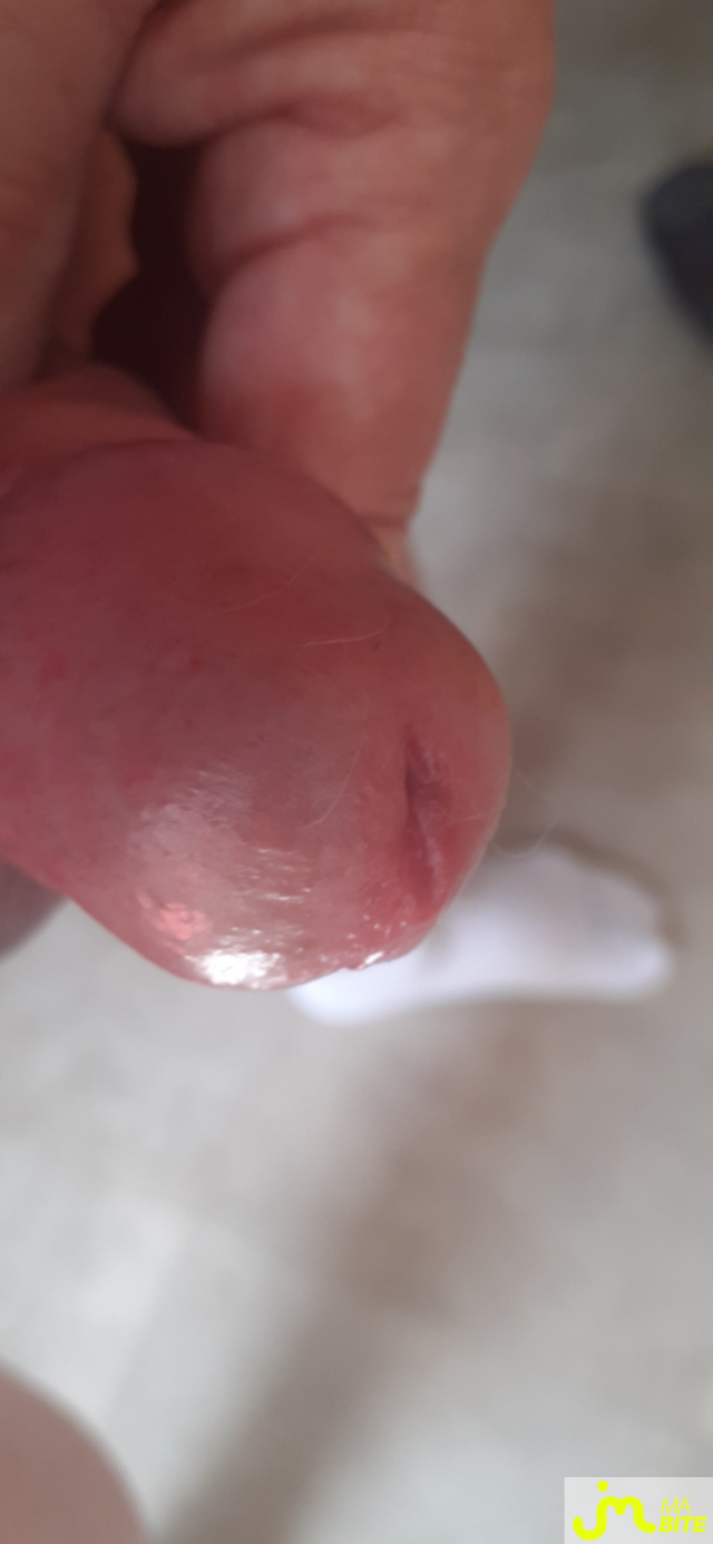 bites de denis 38000