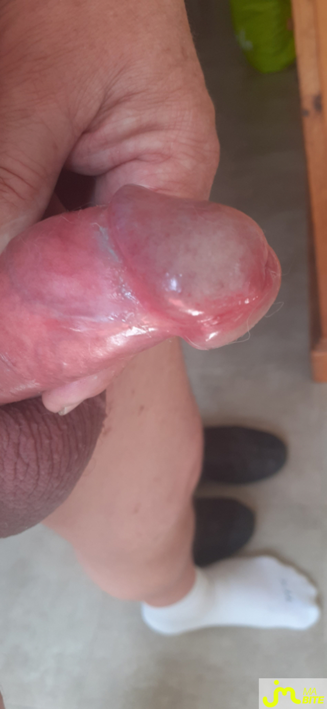 bites de denis 38000