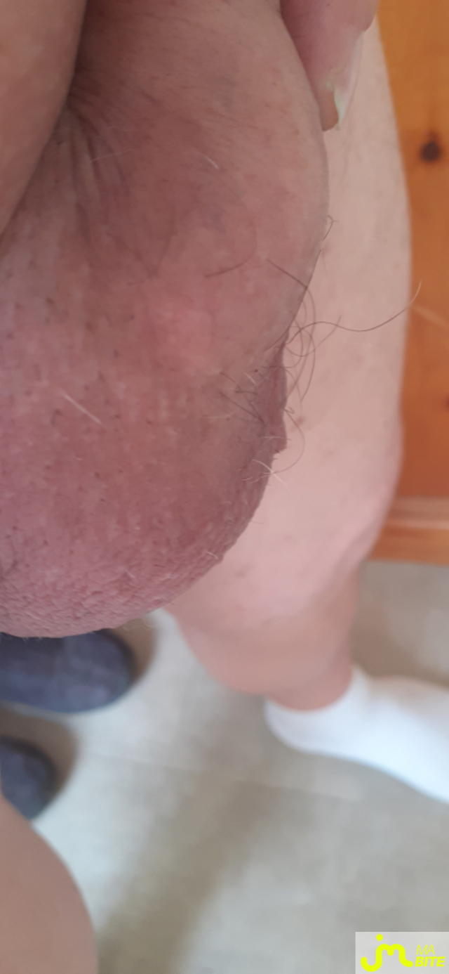 bites de denis 38000