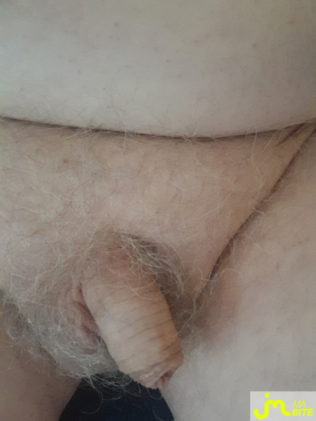 bites de doudodu