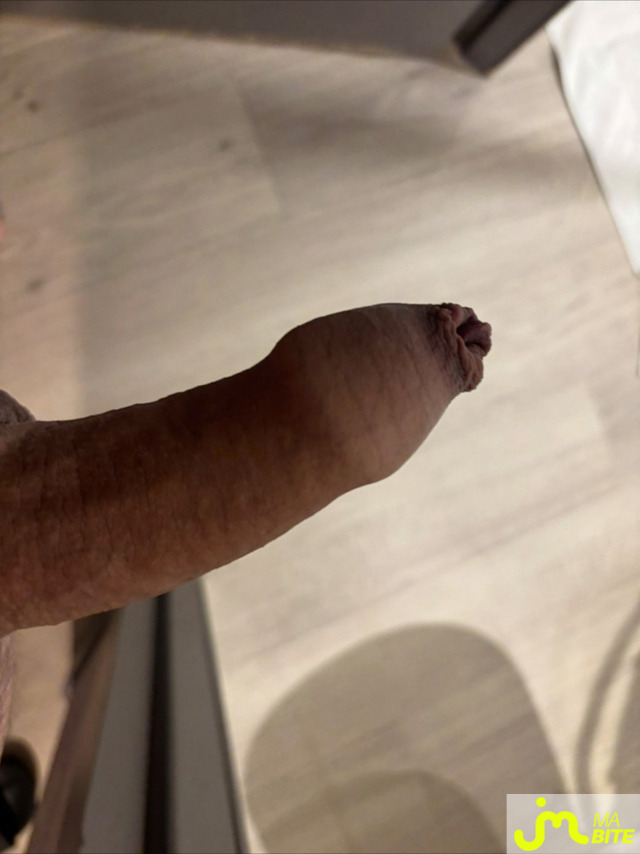bites de moi7240