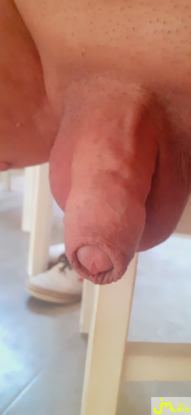 bites de denis 38000