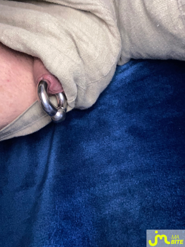 bites de Menelas