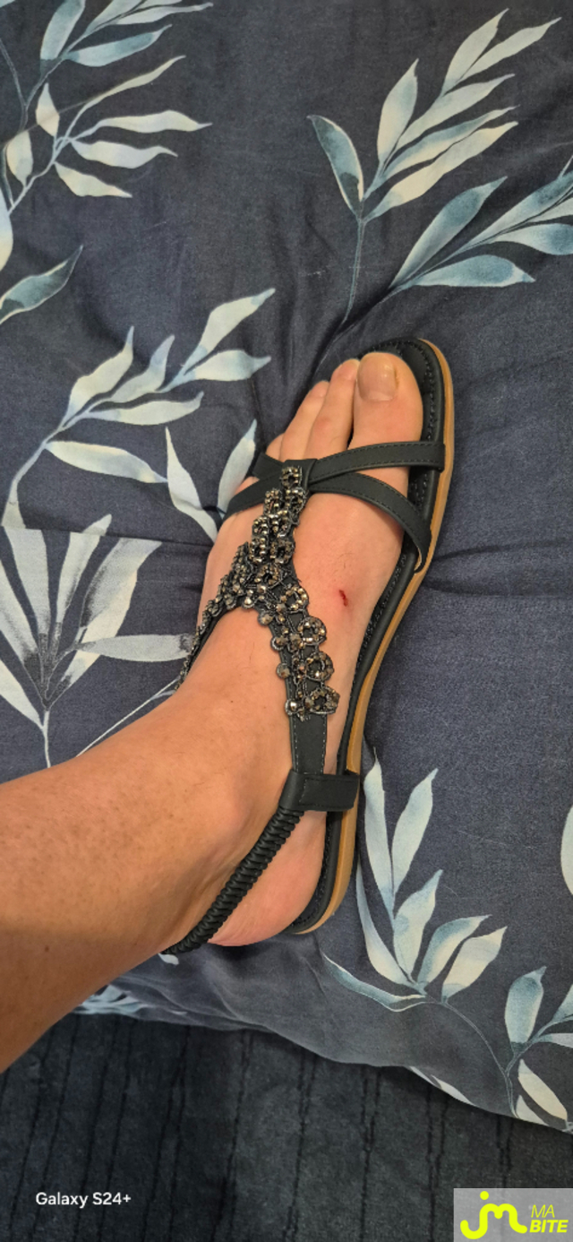 bites de nono 22