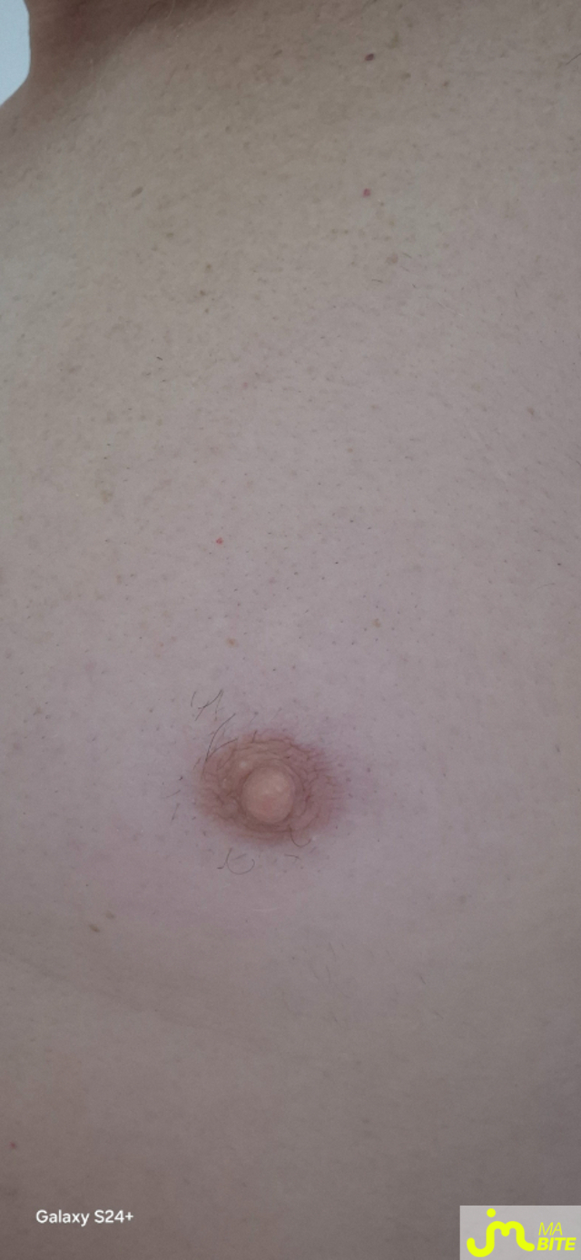 bites de nono 22