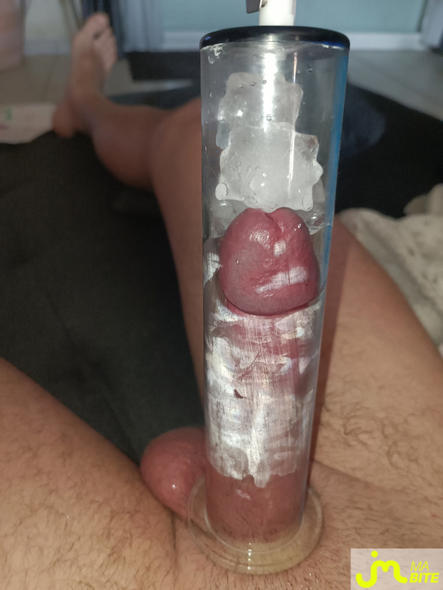 bites de Cpl8793