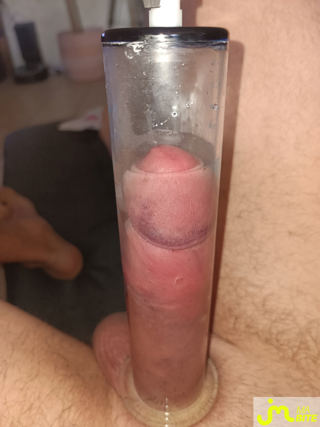 bites de Cpl8793
