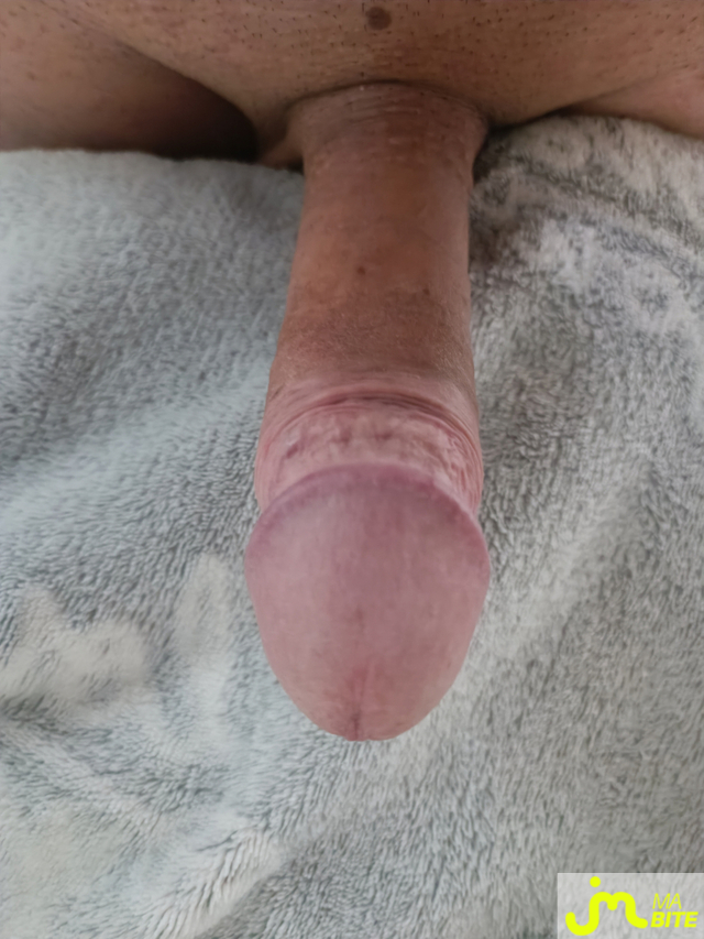 bites de Ragnard142776