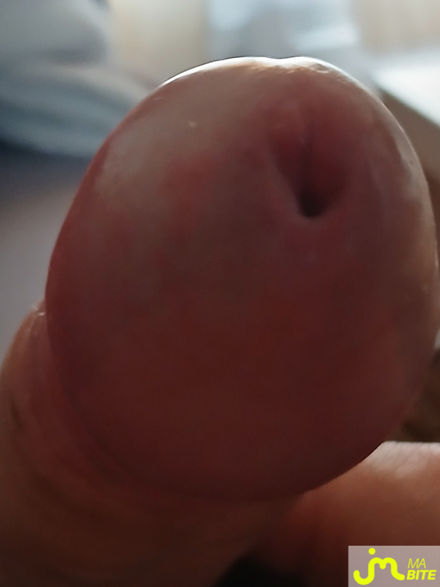 bites de Santseo
