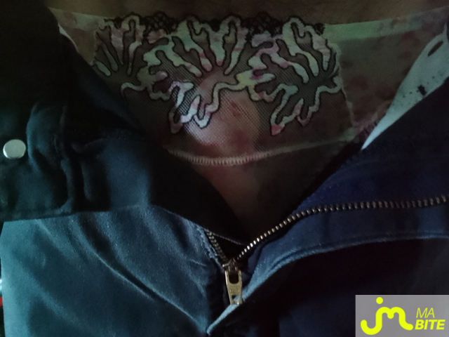 bites de Charlingerie