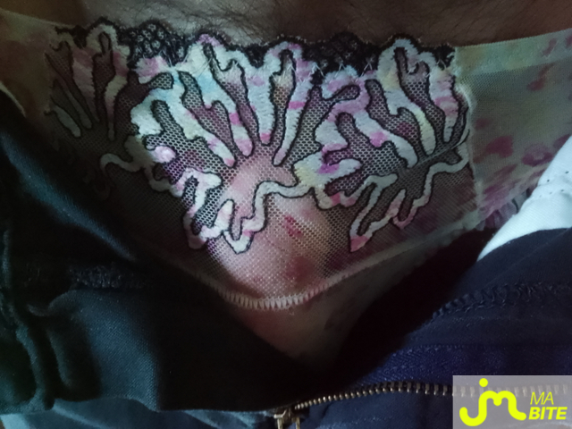 bites de Charlingerie