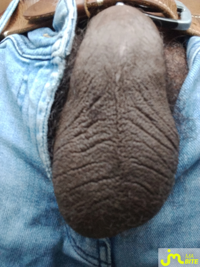 bites de Loupsagedelest