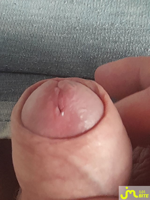 bites de philou67