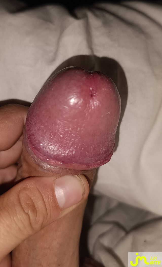 bites de Shadowdiablo