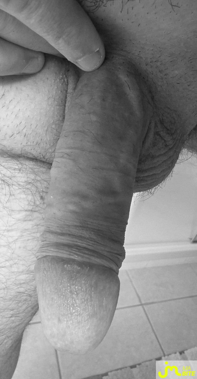 bites de bite_&ocirc;_veines