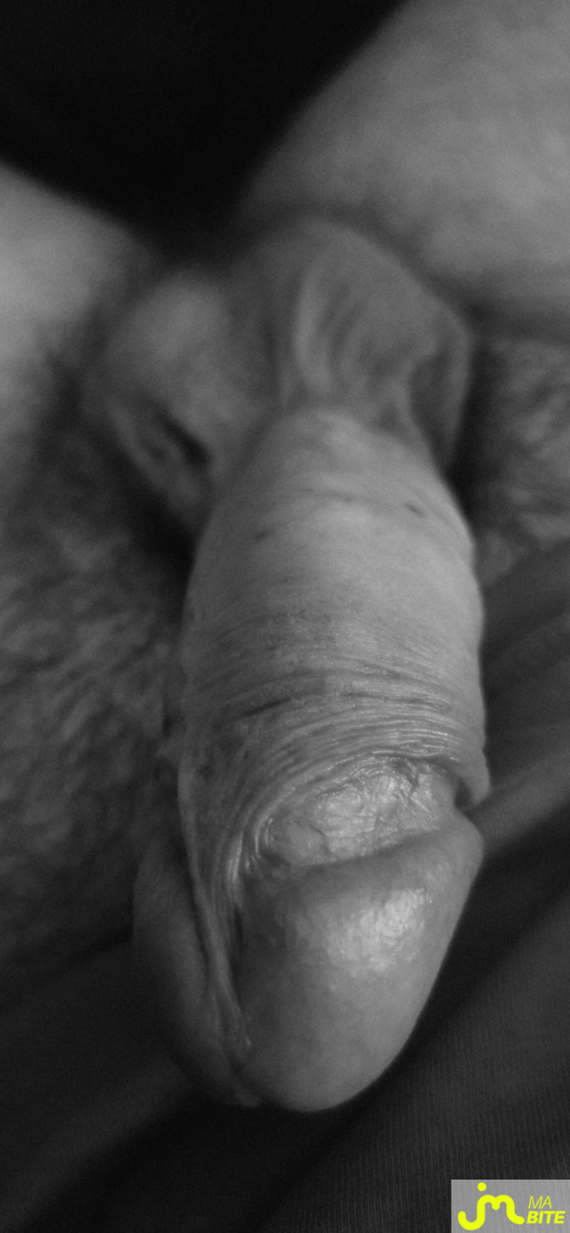 bites de bite_&ocirc;_veines