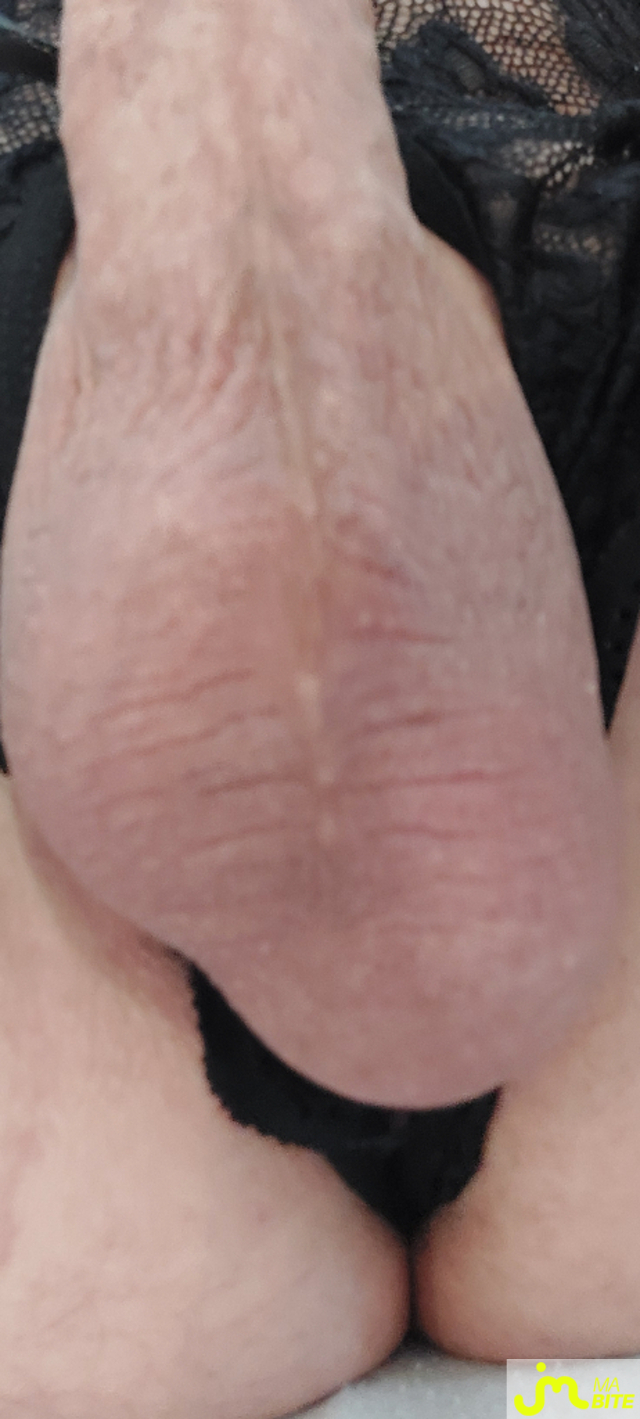 bites de PLUGMAN