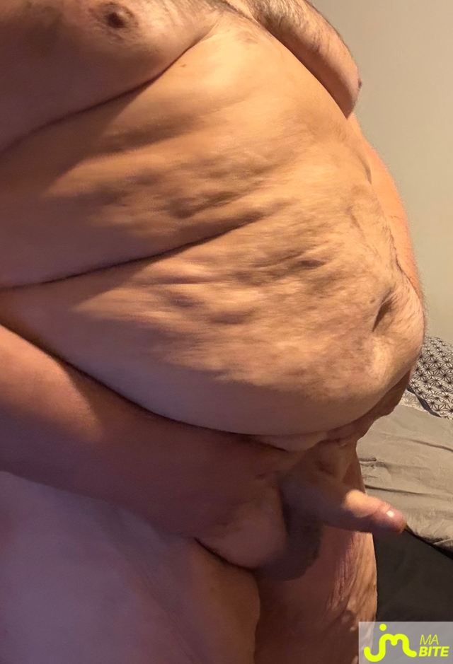 bites de Vix44