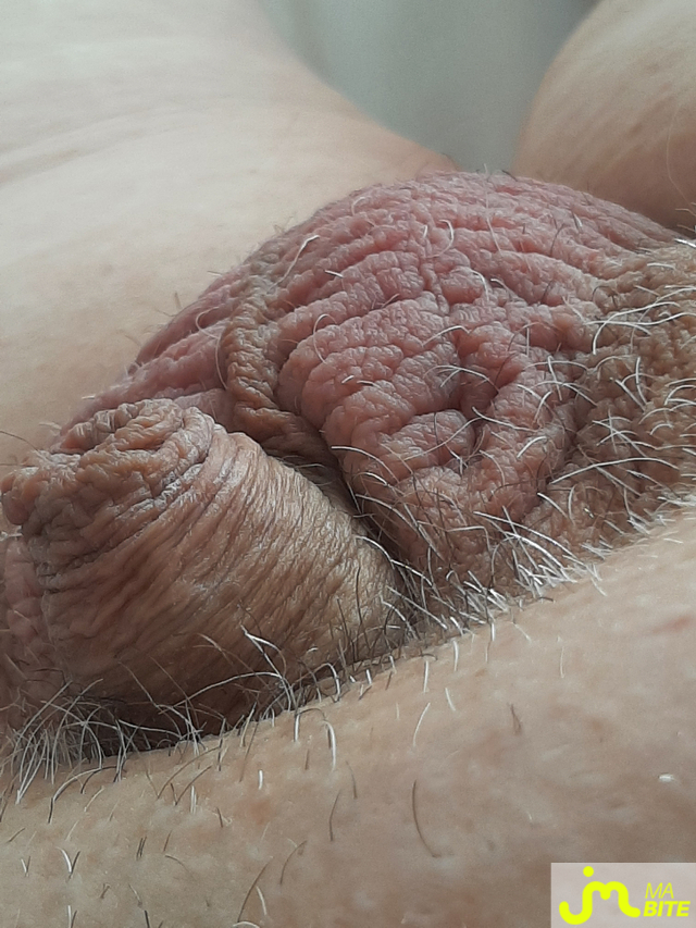 bites de Chaton591