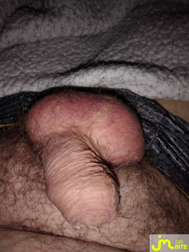 bites de Le brestoas