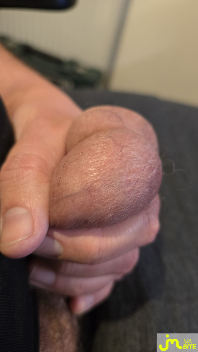 bites de cocogalak