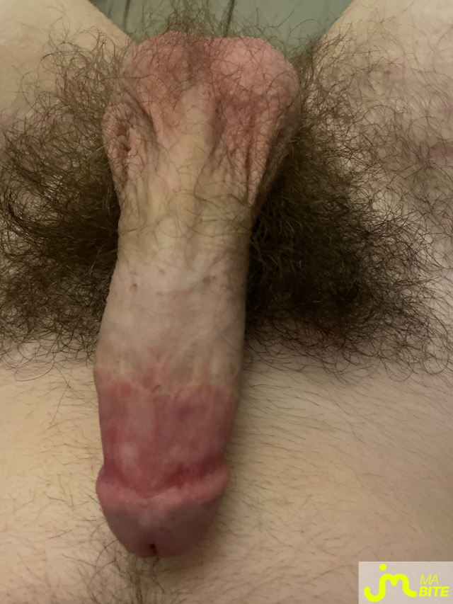 bites de Bitede15cm1567