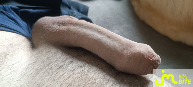bites de pr&eacute;puce 29