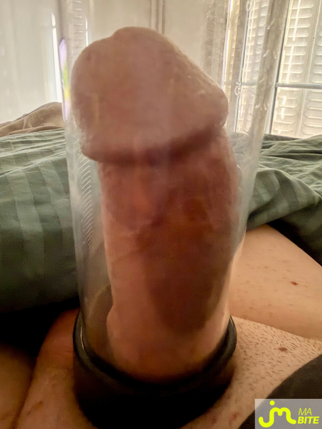 bites de Elbobby