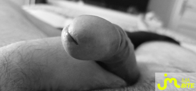 bites de bite_&ocirc;_veines