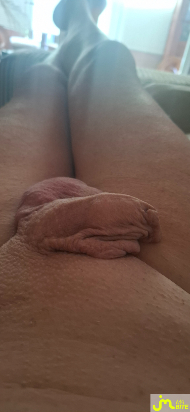 bites de Philocul
