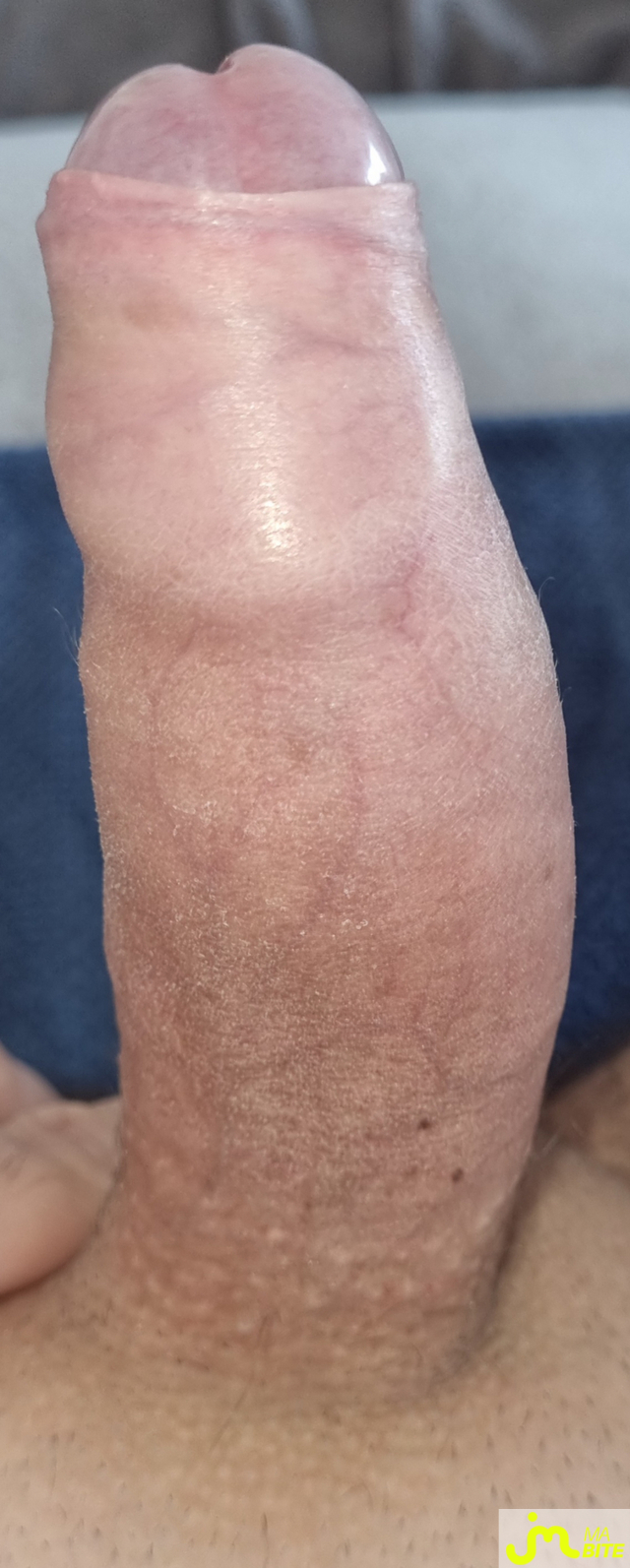 bites de coquindu766
