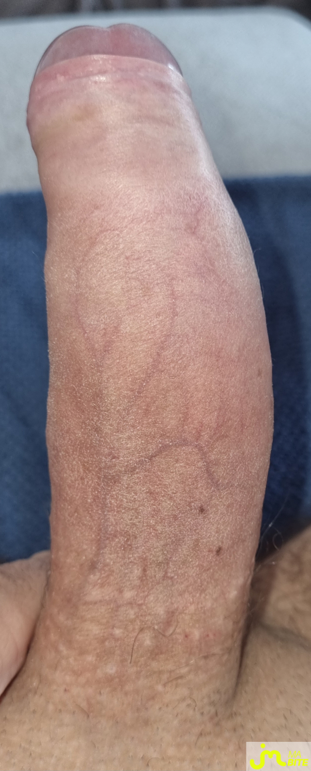 bites de coquindu766