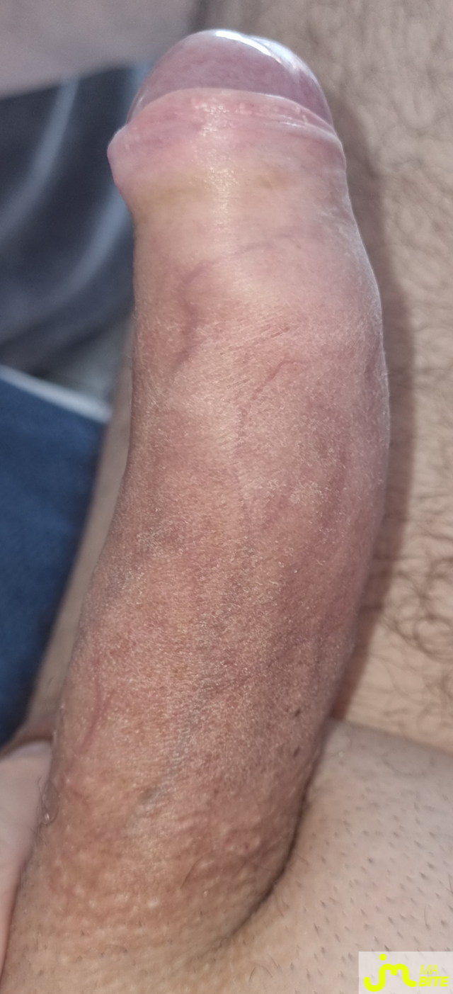 bites de coquindu766