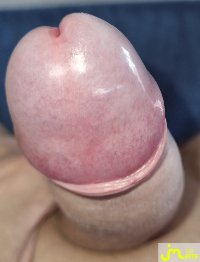 bites de coquindu766