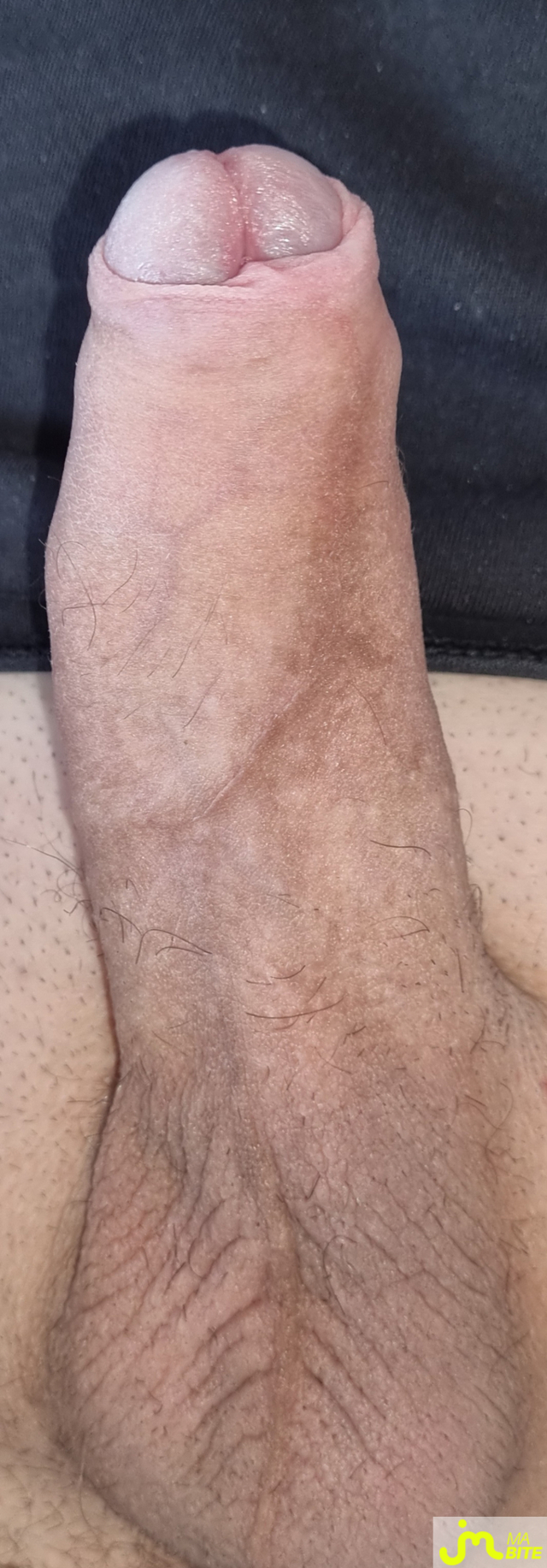 bites de coquindu766