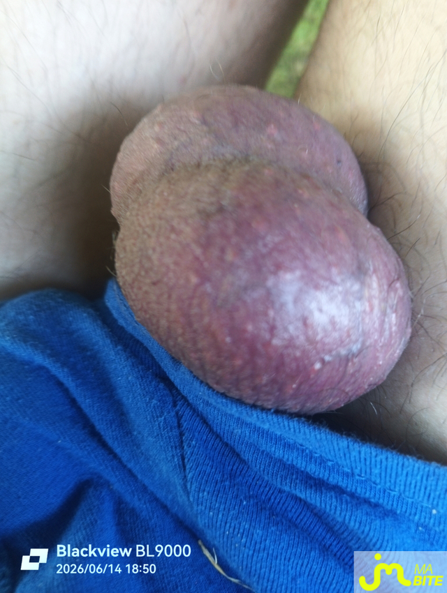 bites de &Eacute;tirement boules