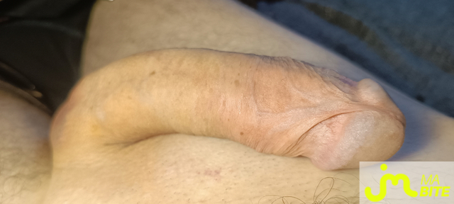 bites de pr&eacute;puce 29