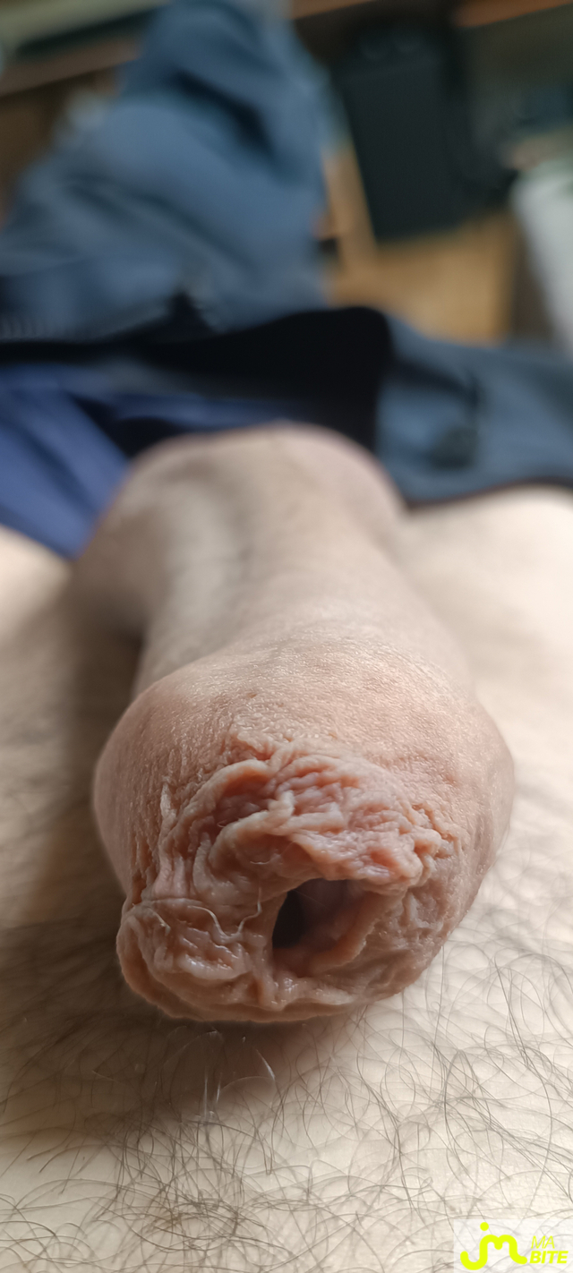 bites de pr&eacute;puce 29