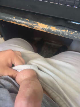 Photos de bites : je complexe grave sur mon p&eacute;nis )=