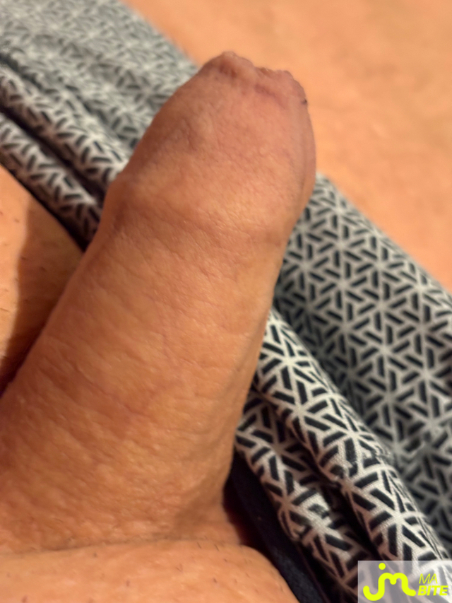 bites de Vix44