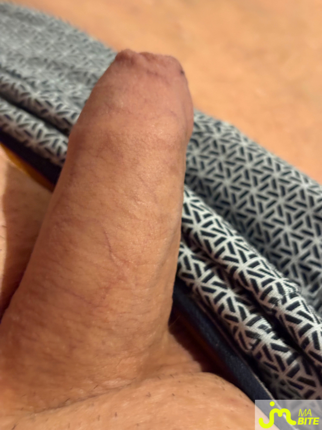 bites de Vix44