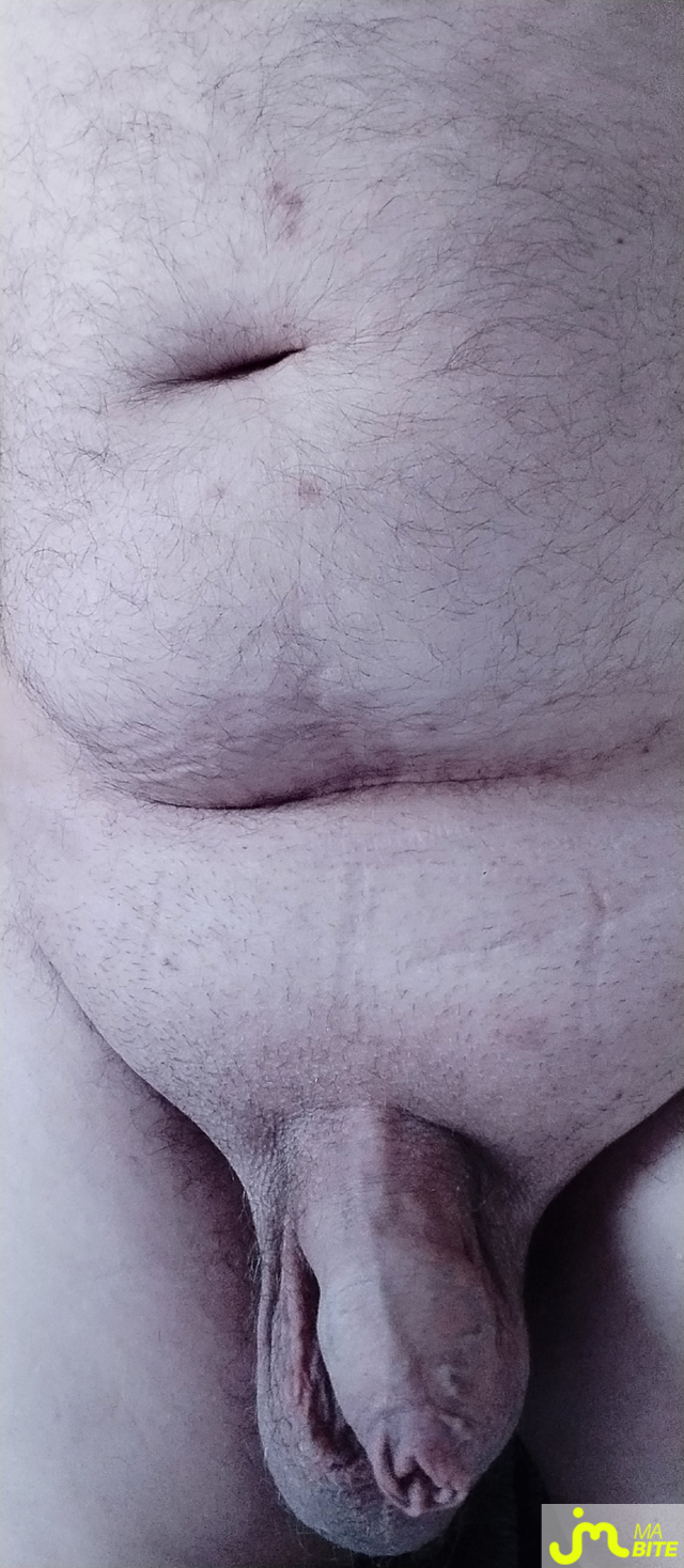 bites de Fred81
