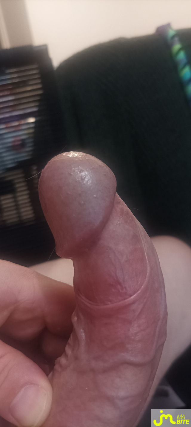 bites de arcel1256942