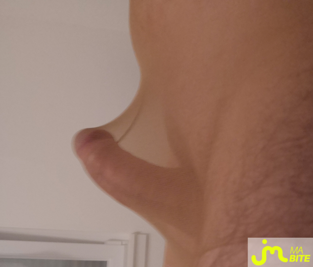 bites de Mercier67