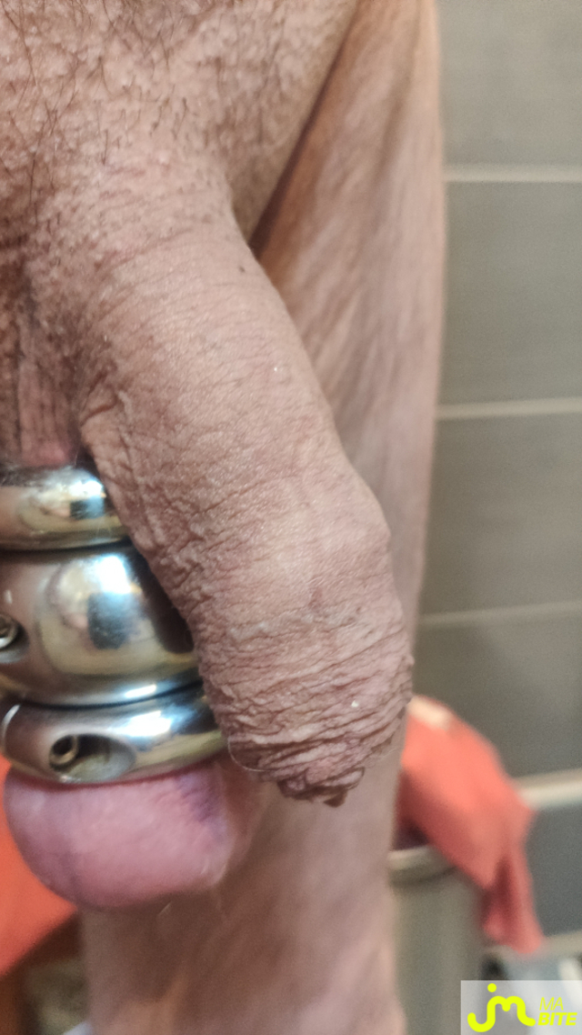 bites de freefred