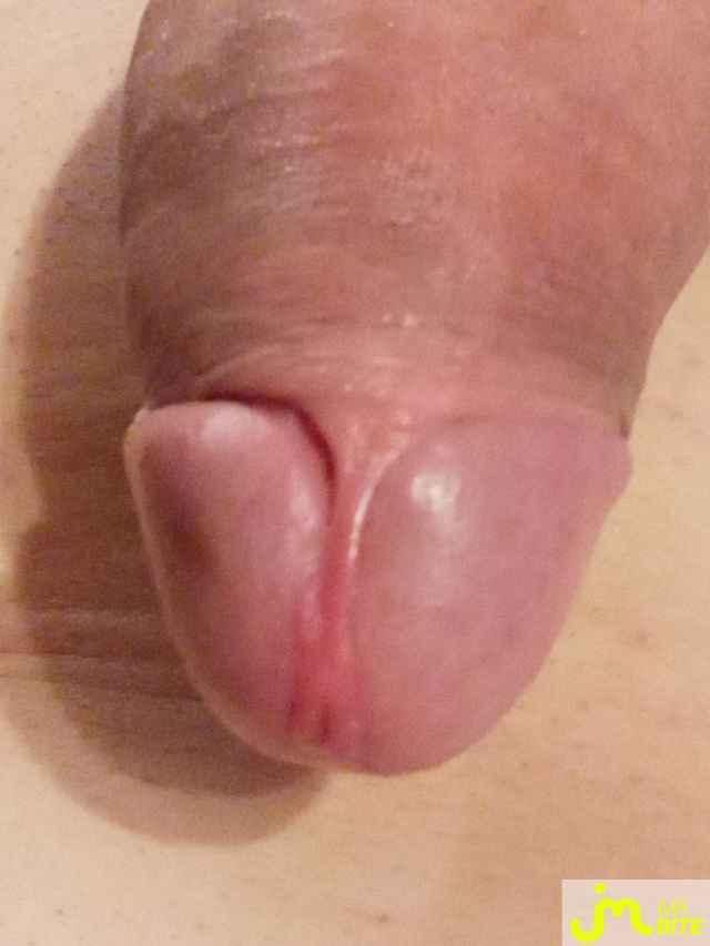 bites de 23@08@