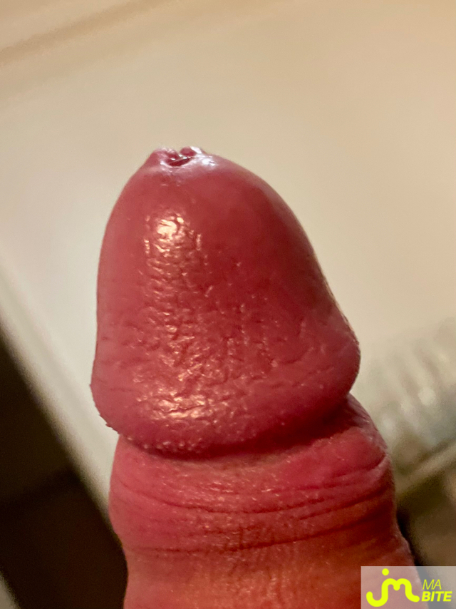 bites de Rob99