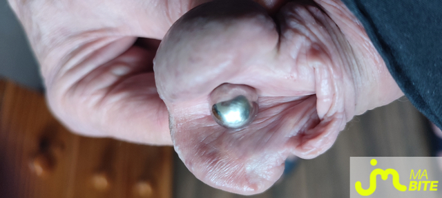 bites de Piercing 